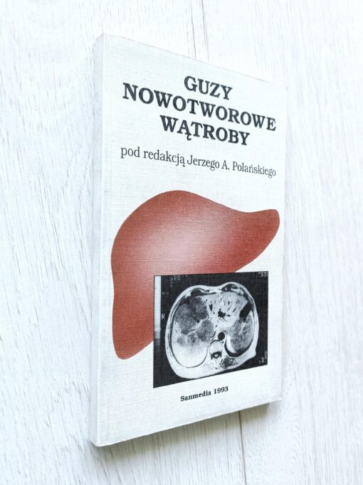 GUZY NOWOTWOROWE WĄTROBY (red.) Polański Jerzy A. - obrazek 3